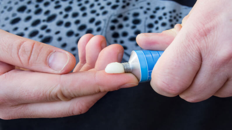 Topical treatment dispensed on a finger
